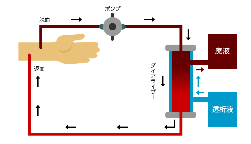 と は 透析 血液