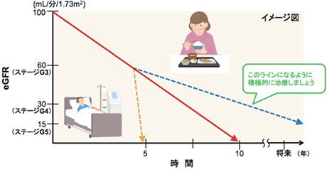 CKDの治療法は？イメージ図