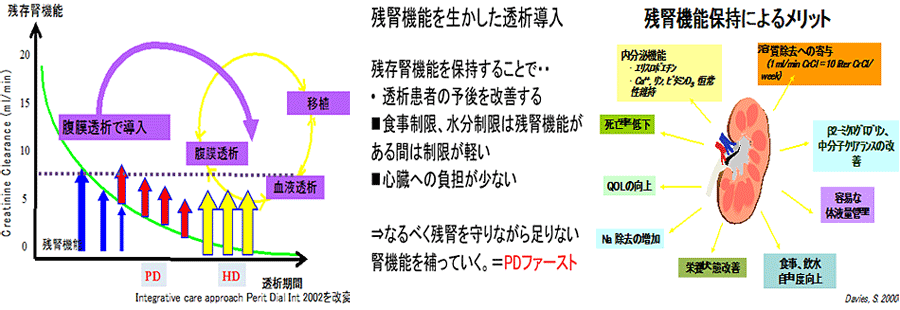 PDファーストとは？