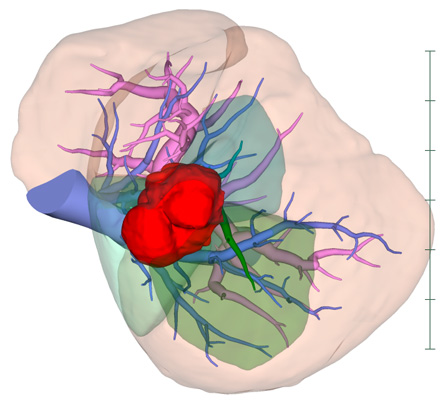 3D解析イメージ図1