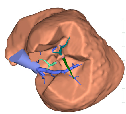 3D解析イメージ図2